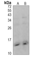 Anti-CXCL4 Antibody