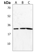 Anti-NT5M Antibody