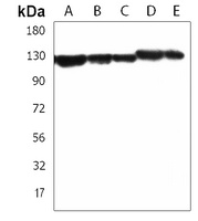 Anti-TACC3 Antibody