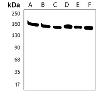 Anti-PDS5B Antibody