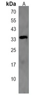 Anti-NAT8L Antibody