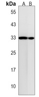 Anti-TMEM158 Antibody