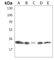 Anti-SSX1 Antibody