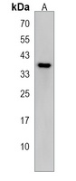 Anti-CXXC5 Antibody