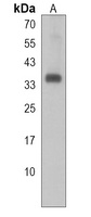 Anti-RNF126 Antibody