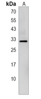 Anti-CLIC2 Antibody