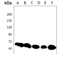 Anti-SNW1 Antibody