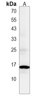 Anti-ATP5G3 Antibody