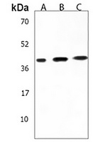 Anti-CSNK2A3 Antibody