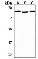 Anti-DMRT2 Antibody