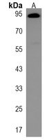 Anti-VAC14 Antibody