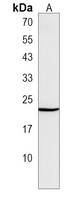 Anti-ROPN1 Antibody