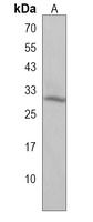 Anti-PTGFR Antibody