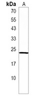 Anti-NACA2 Antibody