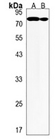 Anti-AHI1 Antibody