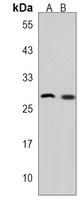 Anti-CELA2B Antibody