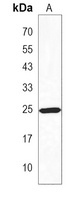 Anti-PET1 Antibody