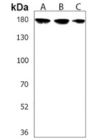 Anti-Calcium Sensing Receptor Antibody