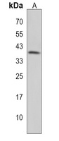 Anti-STPG1 Antibody