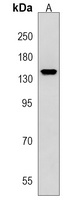 Anti-SCAF8 Antibody