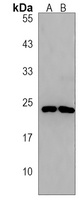 Anti-SEC11C Antibody