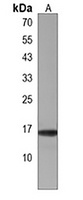 Anti-SPCS1 Antibody