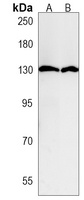 Anti-PPP6R1 Antibody