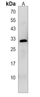 Anti-PRSS42 Antibody