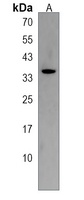 Anti-ANKRD54 Antibody