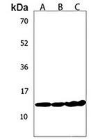 Anti-MTCP1 Antibody