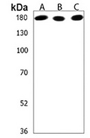 Anti-IQSEC2 Antibody