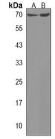 Anti-ZNF257 Antibody