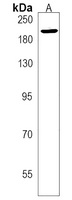 Anti-XRN1 Antibody