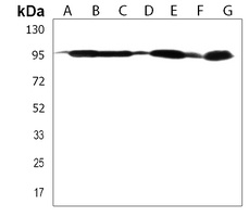 Anti-DNAJC6 Antibody