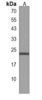 Anti-MRAP Antibody