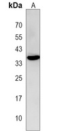 Anti-NSMCE4A Antibody