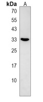 Anti-TBC1D7 Antibody