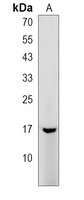 Anti-TYROBP Antibody