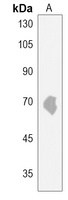 Anti-ACSBG2 Antibody