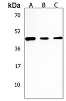 Anti-SGMS2 Antibody