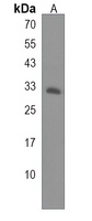 Anti-HSD17B11 Antibody