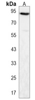 Anti-PATL1 Antibody