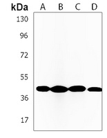 Anti-NDUFS2 Antibody