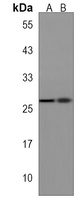Anti-TM4SF4 Antibody