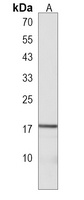 Anti-LYPD1 Antibody