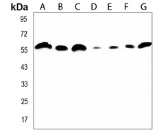 Anti-Artemis Antibody