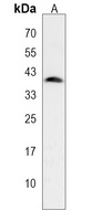 Anti-ADPRHL2 Antibody