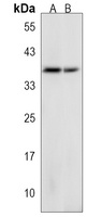Anti-GSPT2 Antibody