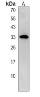 Anti-ECHDC1 Antibody