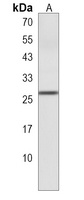 Anti-NMRK1 Antibody